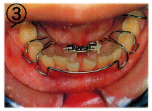 矯正歯科3